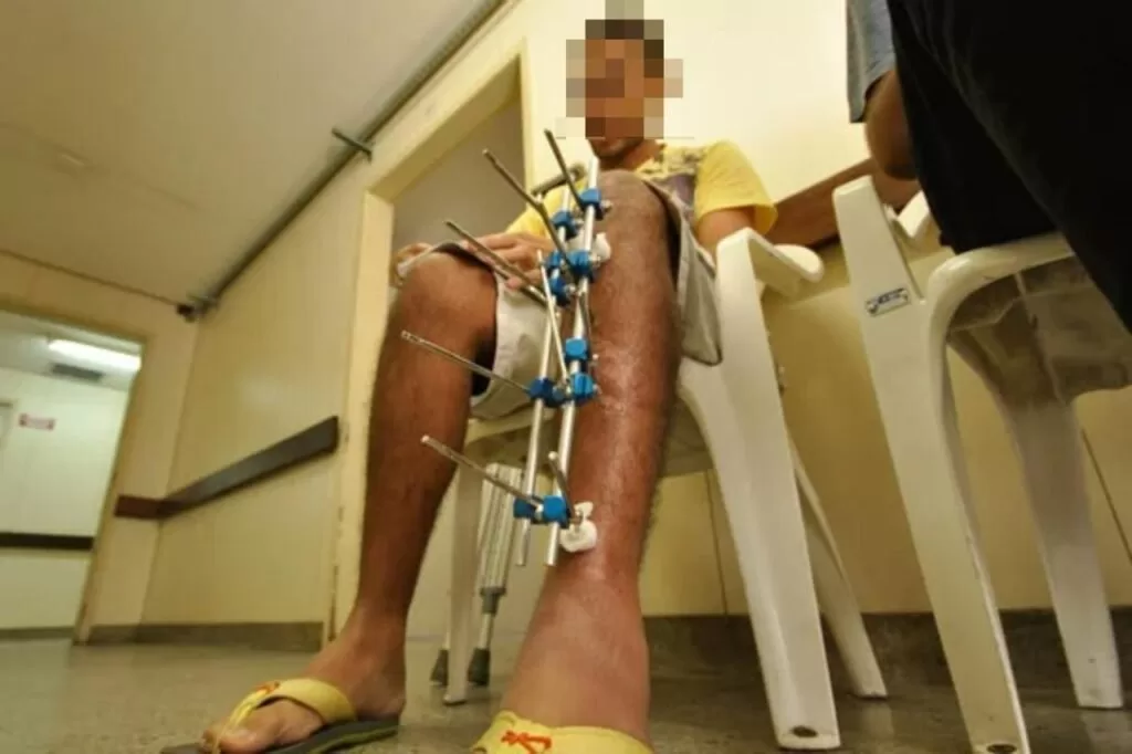 Três acidentes com motociclistas mobilizam equipes de emergência em Alfenas